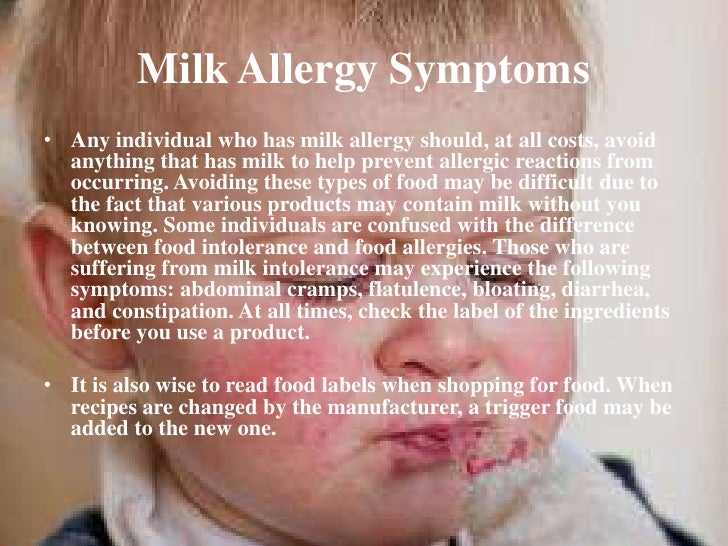An easy explanation on how allergies develop