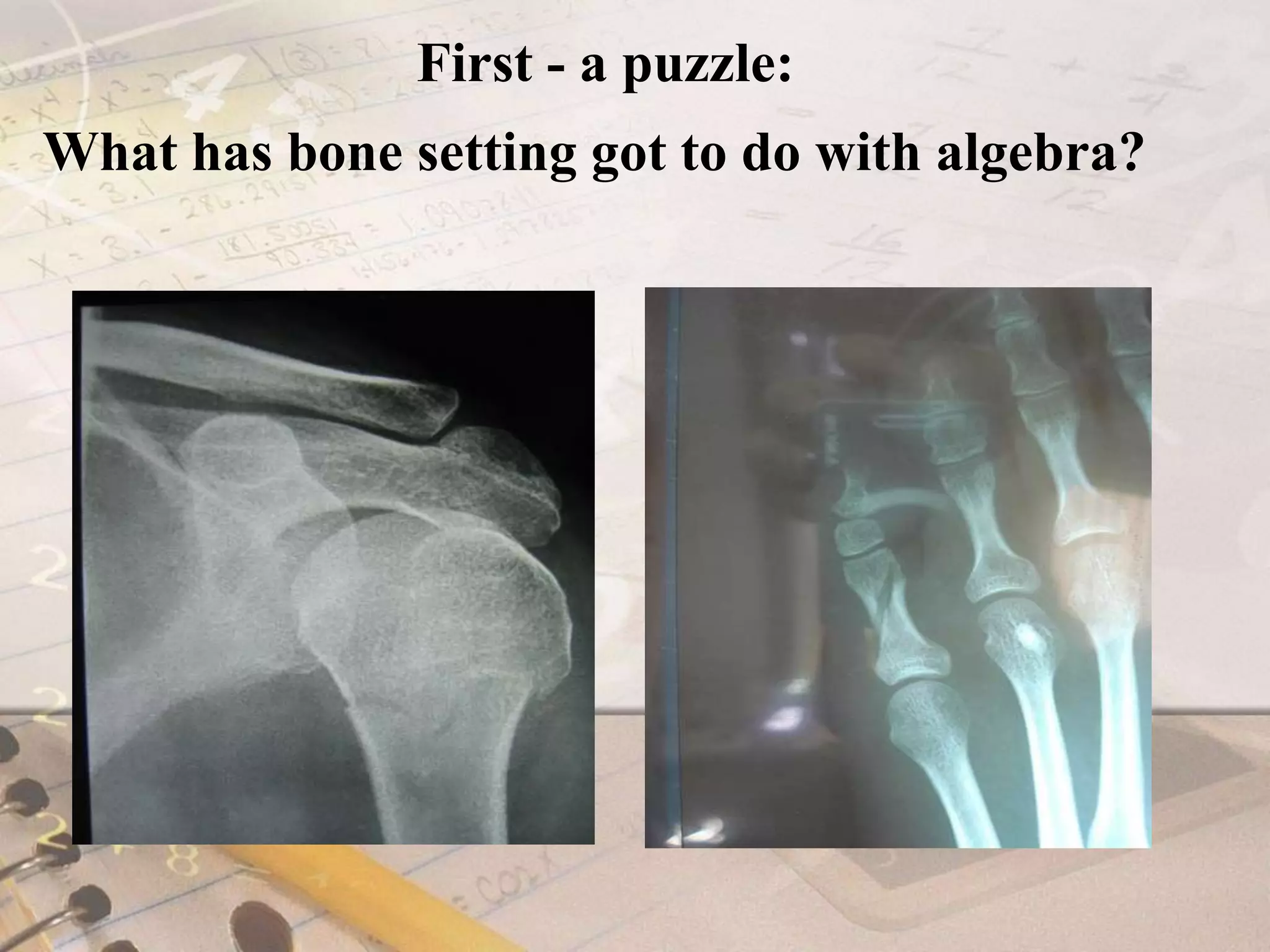First - a puzzle:What has bone setting got to do with algebra?