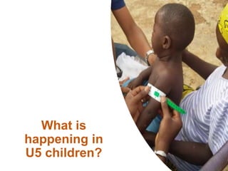 Multiple malnutrition burdens in children under 5 and women of reproductive age in West Africa