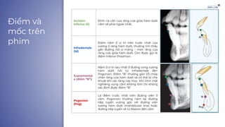[ANE] Điểm và mốc trên phim Cephalometric mặt bên.pdf
