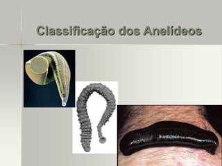 Classificação dos Anelídeos

 