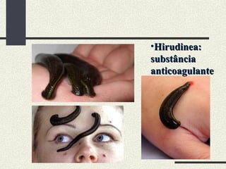 •Hirudinea:
Hirudinea:
substância
substância
anticoagulante
anticoagulante
 