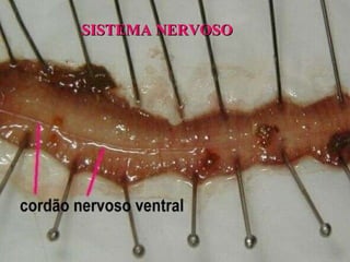 SISTEMA NERVOSO  