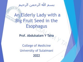 ‫الرحيم‬ ‫الرحمن‬ ‫هللا‬ ‫بسم‬
An Elderly Lady with a
Big Fruit Seed in the
Esophagus
Prof. Abdulsalam Y Taha
College of Medicine
University of Sulaimani
2022 1
 