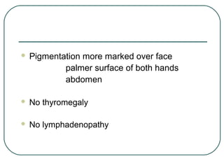  Pigmentation more marked over face
palmer surface of both hands
abdomen
 No thyromegaly
 No lymphadenopathy
 