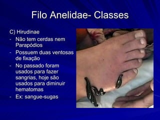 Filo Anelidae- Classes C) Hirudinae Não tem cerdas nem Parapódios Possuem duas ventosas de fixação No passado foram usados para fazer sangrias, hoje são usados para diminuir hematomas Ex: sangue-sugas 