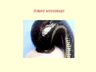 Hirudo medicinalis 