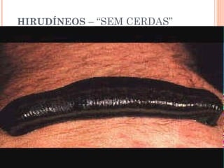 HIRUDÍNEOS – “SEM CERDAS” 
 
