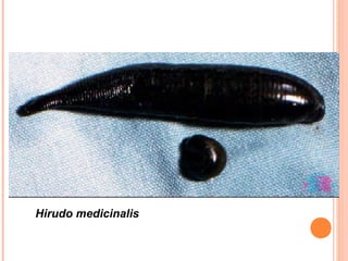 Hirudo medicinalis 
 