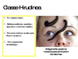 Ex: sanguessugas; Habitam ambientes marinhos; água doce e terrestres úmidos; Possuem ventosas usadas para fixar-se na presa; São ectoparasitas hematófagos. Classe Hirudinea  Antigamente usado na medicina para diminuírem hematomas; 