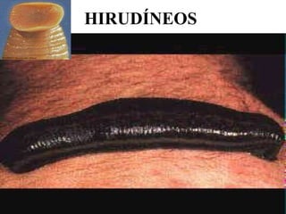 HIRUDÍNEOS
 