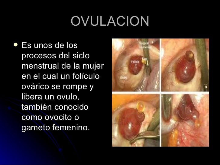que es una ovulacion dolorosa