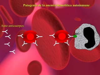 Auto anticuerpos RFc Patogenia de la anemia hemolítica autoinmune 