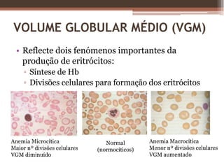 Adenocarcinoma do cólonFig.1 – Colonoscopia.