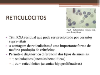 RESUMO ACHADOS CLÍNICOS↓ hemoglobina