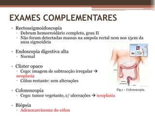 EXAMES COMPLEMENTARESRectossigmoidoscopia