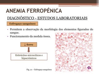 HGM - conteúdo médio de Hb por eritrócito (picogramas)