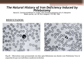 Sopro sistólico de ejecção