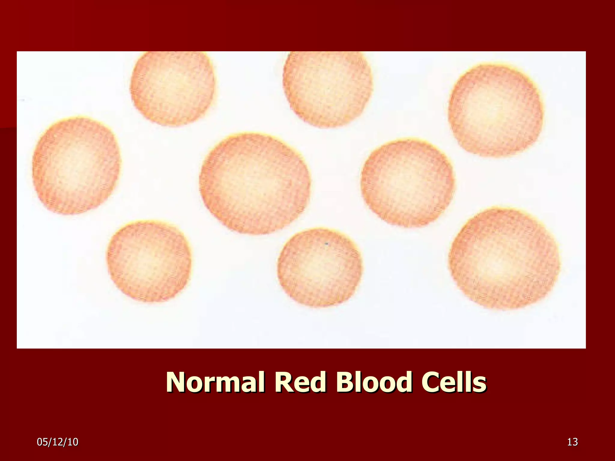 Normal Red Blood Cells 