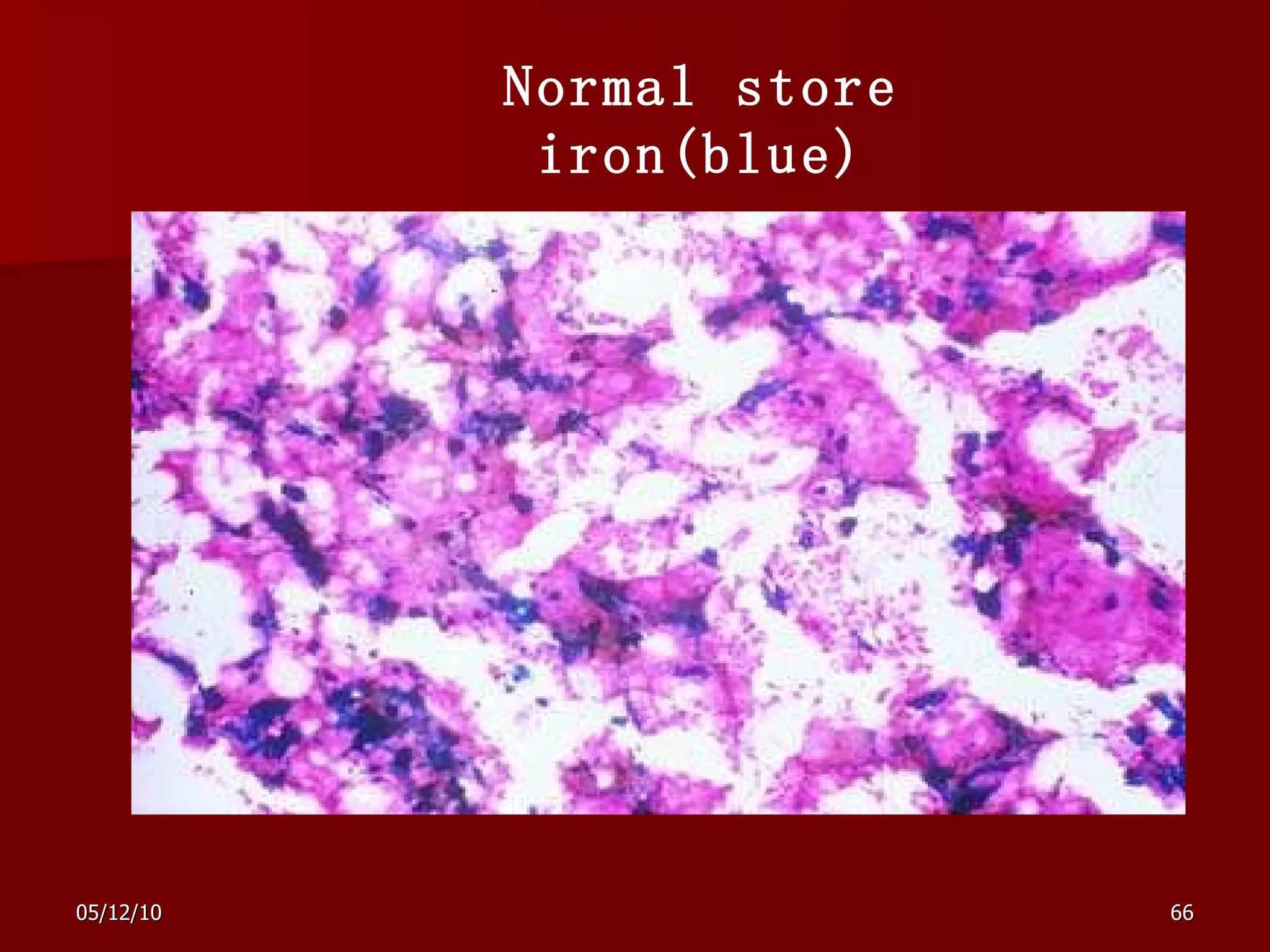 Normal store iron(blue) 