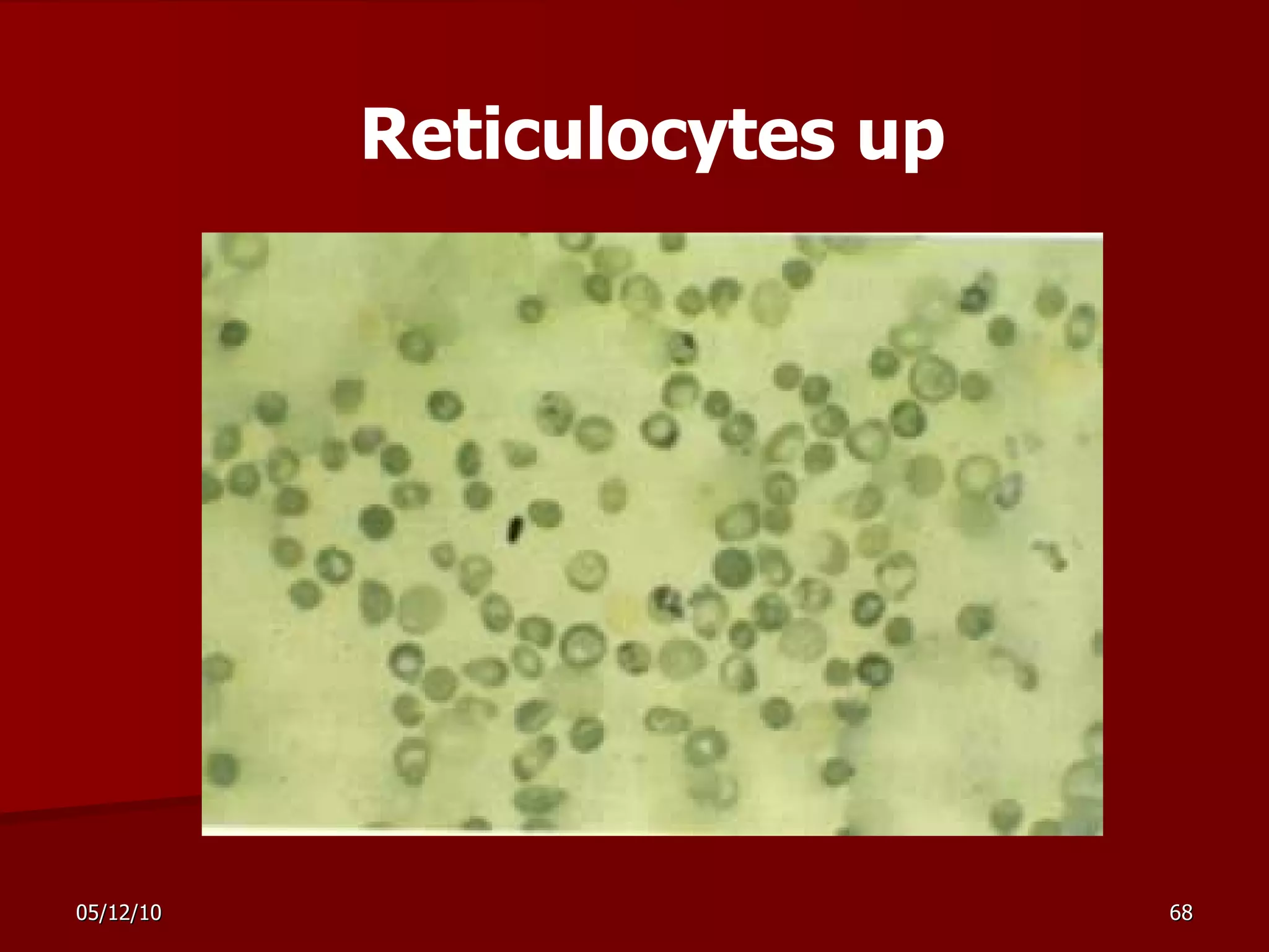 Reticulocytes up 