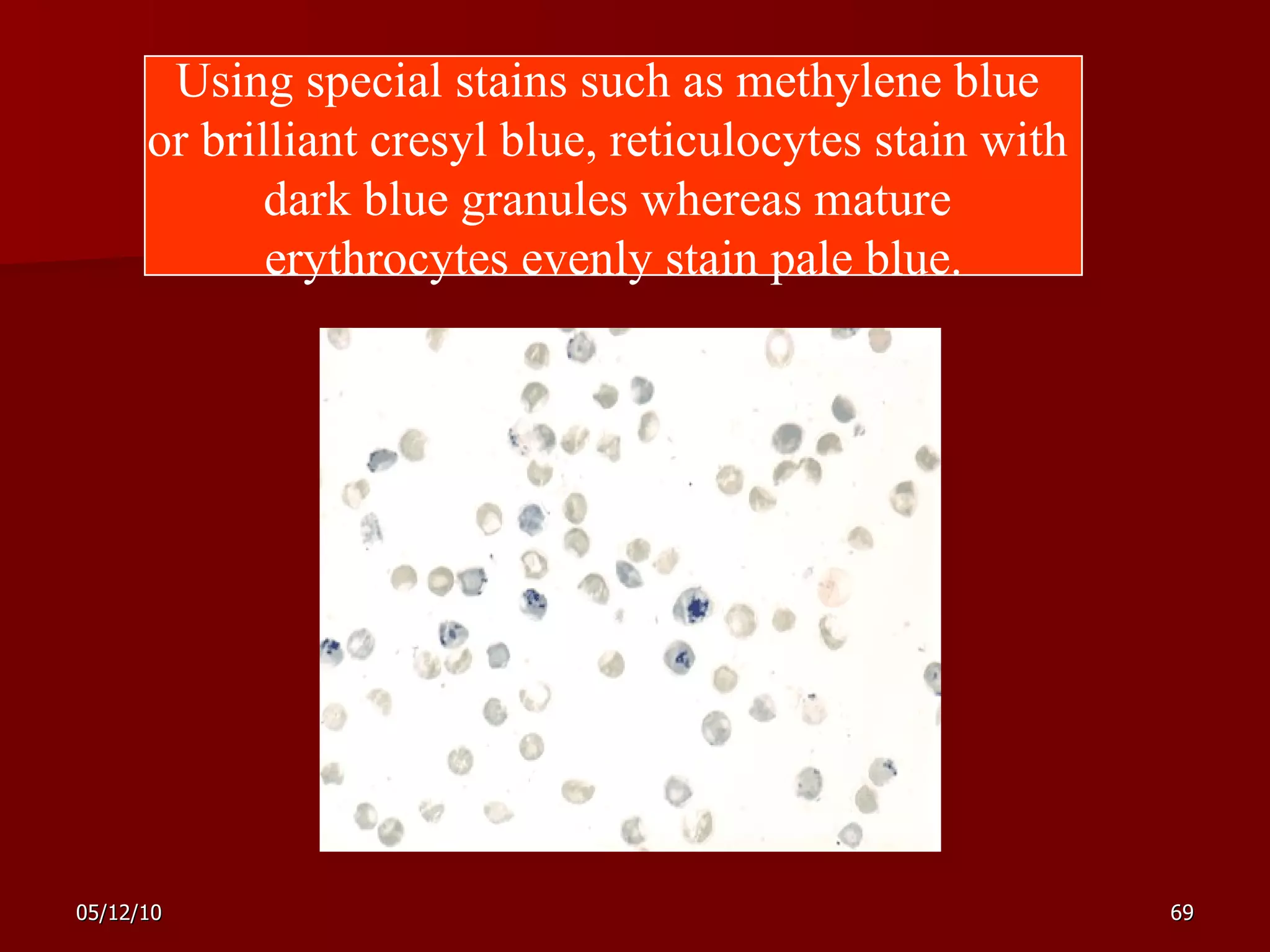 Using special stains such as methylene blue  or brilliant cresyl blue, reticulocytes stain with  dark blue granules whereas mature  erythrocytes evenly stain pale blue. 