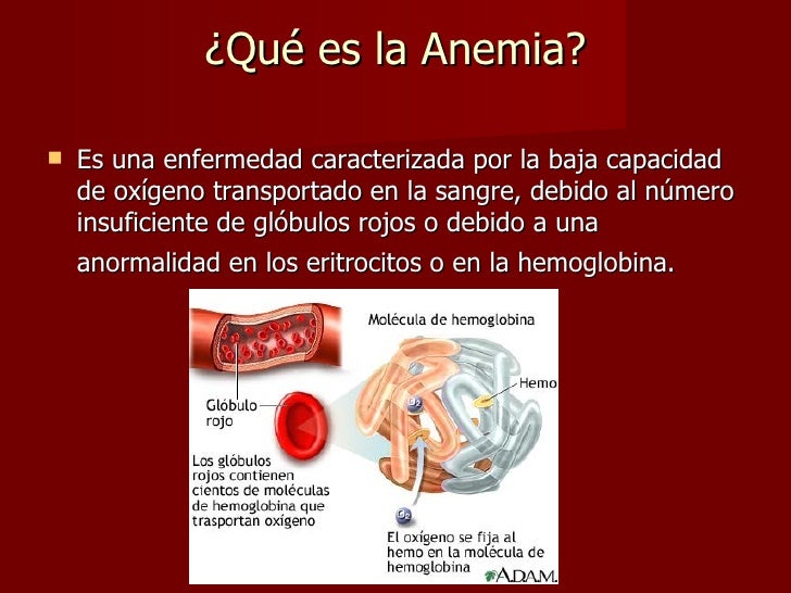 Anemia