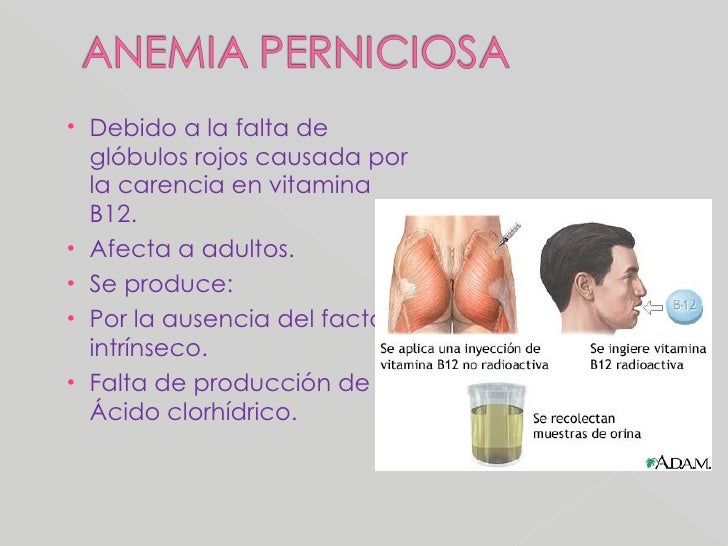 Anemia