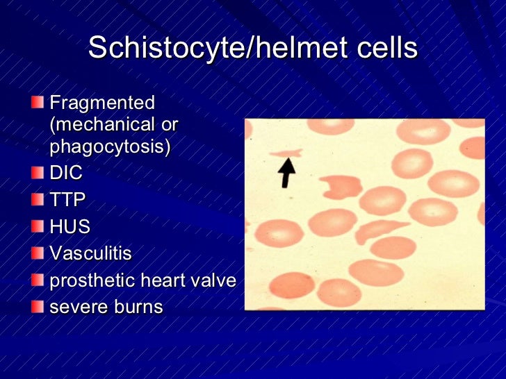 Medicine 5th year, 5th & 6th lectures (Dr. Sabir)