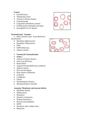 Causes:
   • Iron deficiency
   • Thalassemia minor
   • Anemia of chronic disease
   • Lead poisoning
   • Congenital sideroblastic anemia
   • ß-Thalassemia intermedia and major
   • Hemoglobin H or E disease


Normochromic Anemias
    • Most common cause: Acute blood loss
classification:
    • Hereditary Spherocytosis
    • Hereditary Elliptocytosis
    • PNH
    • G6PD deficiency
    • Aplastic anemia

   •   Normocytic Normochromic
   •   causes :
   •   Anemia of chronic disease
   •   Early iron deficiency
   •   Renal failure
   •   Acquired immunodeficiency syndrome
   •   Aplastic anemia
   •   Pure red cell aplasia
   •   Bone marrow infiltration
   •   Leukemia
   •   Lymphoma
   •   Cancer
   •   Granulomatous diseases
   •   Myeloproliferative disorder

   Anaemia; Membrane and enzyme defects
   • Membrane defects
   • Elliptocytosis
   • Hemolysis
   • Stomato-ovalocytosis
   • Without haemolysis
   • Red cell enzymopathies
   • G6PD
   • Hemolysis after oxidant stress
   • Blood loss
 