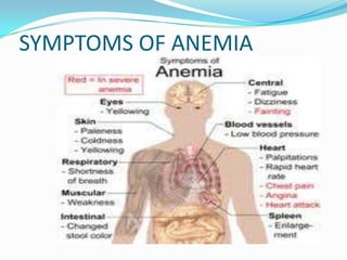 Anemia | PPTX