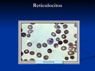 Reticulocitos 