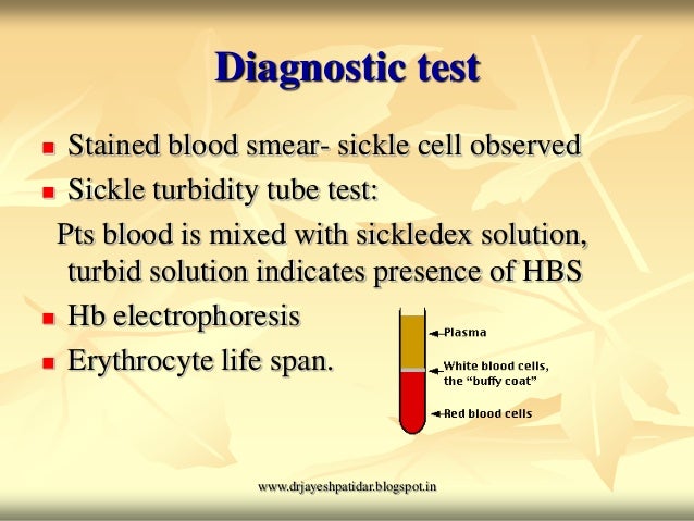 test heart monitor Anemia test heart monitor Anemia