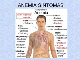 ANEMIA SINTOMAS
 