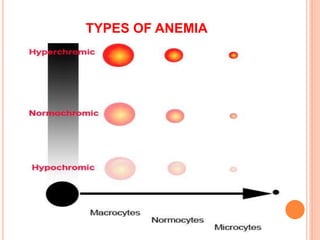 TYPES OF ANEMIA
 
