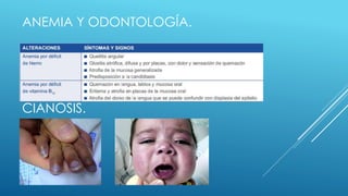 ANEMIA Y ODONTOLOGÍA.
CIANOSIS.
 