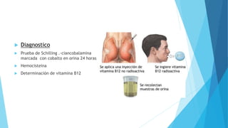  Diagnostico 
 Prueba de Schilling .-ciancobalamina 
marcada con cobalto en orina 24 horas 
 Hemocisteina 
 Determinación de vitamina B12 
 