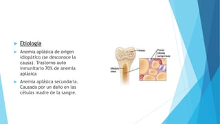  Etiología 
 Anemia aplásica de origen 
idiopático (se desconoce la 
causa). Trastorno auto 
inmunitario 70% de anemia 
aplásica 
 Anemia aplásica secundaria. 
Causada por un daño en las 
células madre de la sangre. 
 