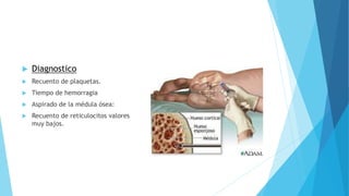  Diagnostico 
 Recuento de plaquetas. 
 Tiempo de hemorragia 
 Aspirado de la médula ósea: 
 Recuento de reticulocitos valores 
muy bajos. 
 