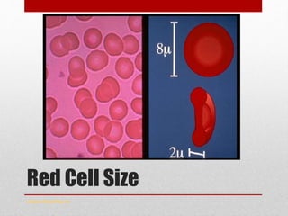 Red Cell Size
www.drsarma.in
 