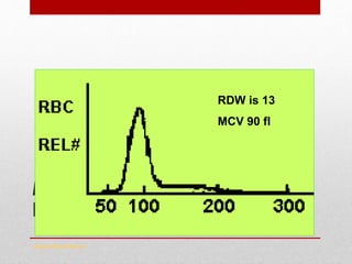 Anaemia Workup – 3rd Test
Red cell Distribution Width – RDW
www.drsarma.in
RDW < 13
Mean 90 fl
RDW is 13
MCV 90 fl
 