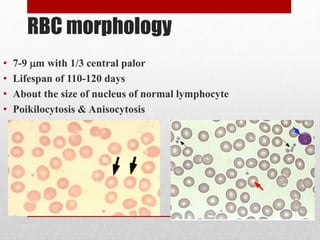 RBC morphology
• 7-9 m with 1/3 central palor
• Lifespan of 110-120 days
• About the size of nucleus of normal lymphocyte
• Poikilocytosis & Anisocytosis
 
