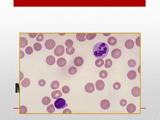 Macrocytosis -MBA
www.drsarma.in
 