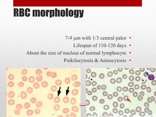 RBC morphology
•7-9 m with 1/3 central palor
•Lifespan of 110-120 days
•About the size of nucleus of normal lymphocyte
•Poikilocytosis & Anisocytosis
 