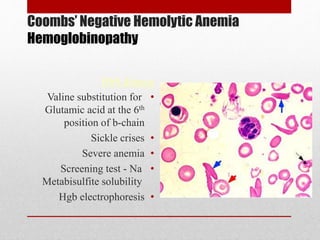 Coombs’ Negative Hemolytic Anemia
Hemoglobinopathy
HbS disease
•Valine substitution for
Glutamic acid at the 6th
position of b-chain
•Sickle crises
•Severe anemia
•Screening test - Na
Metabisulfite solubility
•Hgb electrophoresis
 