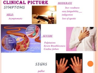 CLINICAL PICTURE MODERATE
SYMPTOMS Incr. weakness
easy fatiguibility
MILD indigestion
Asymptomatic loss of apetite
SEVERE
Palpitaions
Severe Breathlessness
Cardiac failure
SIGNS
pallor
 