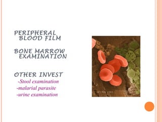 PERIPHERAL
BLOOD FILM
BONE MARROW
EXAMINATION
OTHER INVEST
-Stool examination
-malarial parasite
-urine examination
 