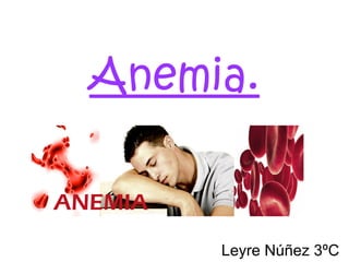 Anemia.
Leyre Núñez 3ºC
 