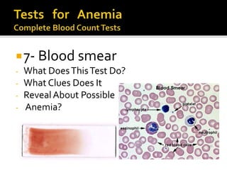 7- Blood smear
- What DoesThisTest Do?
- What Clues Does It
- RevealAbout Possible
- Anemia?
 