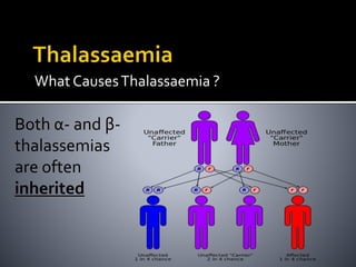What CausesThalassaemia ?
Both α- and β-
thalassemias
are often
inherited
 